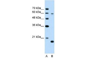 SLC38A4 antibody used at 2.