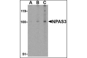 Western blot analysis of NPAS3 in rat brain tissue lysate with this product at (A) 0. (NPAS3 Antikörper  (Center))