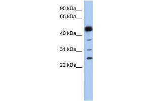WB Suggested Anti-PGDS Antibody Titration:  0. (PTGDS Antikörper  (N-Term))