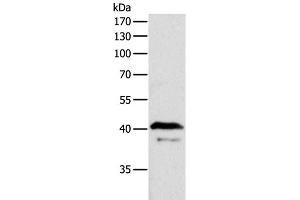 Western Blot analysis of Mouse brain tissue using ADAP1 Polyclonal Antibody at dilution of 1:500 (ADAP1 Antikörper)
