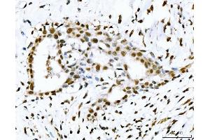 IHC analysis of 53BP1/TP53BP1 using anti-53BP1/TP53BP1 antibody (ABIN7599869). (TP53BP1 Antikörper  (AA 1239-1972))