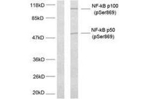 Western blot analysis of extracts from MDA-MB-435 cells treated with TNF-alpha, using NF-kappaB p100/p52 (Phospho-Ser869) Antibody.