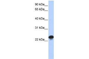 WB Suggested Anti-CAPS Antibody Titration: 0. (Calcyphosine Antikörper  (N-Term))