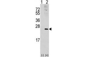 Western blot analysis of RAC1 antibody and 293 cell lysate (2 ug/lane) either nontransfected (Lane 1) or transiently transfected with the RAC1 gene (2). (RAC1 Antikörper  (AA 49-78))