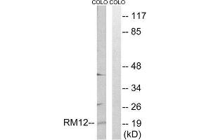 Western Blotting (WB) image for anti-Mitochondrial Ribosomal Protein L12 (MRPL12) (Internal Region) antibody (ABIN1850542) (MRPL12 Antikörper  (Internal Region))