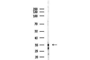 Western blot analysis of lysates from EC304 cells(starvation 24h treatment), using COL18 Antibody at 1/1000 dilution.