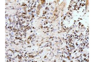 IHC analysis of IFI16 using anti-IFI16 antibody (ABIN7600374). (IFI16 Antikörper  (AA 183-743))