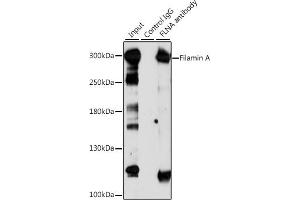 Immunoprecipitation analysis of 200 μg extracts of Jurkat cells, using 3 μg Filamin A antibody (ABIN6127907, ABIN6140677, ABIN6140679 and ABIN6214030). (Filamin A Antikörper  (AA 2348-2647))
