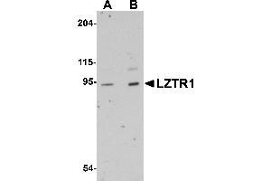 Western Blotting (WB) image for anti-Leucine-Zipper-Like Transcription Regulator 1 (LZTR1) (N-Term) antibody (ABIN1031446)