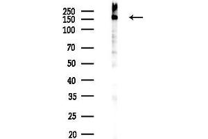 anti-Topoisomerase (DNA) II alpha 170kDa (TOP2A) (pThr1343) antibody