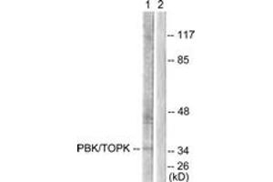Western blot analysis of extracts from COS7 cells, treated with Nocodazole 1ug/ml 16h, using PBK/TOPK (Ab-9) Antibody. (PBK Antikörper  (AA 1-50))