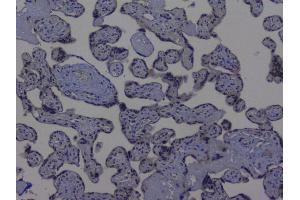 IHC analysis of NRF1 using anti-NRF1 antibody (ABIN6719347). (NRF1 Antikörper  (AA 246-503))