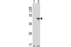 Western Blotting (WB) image for anti-USP12,USP46 antibody (ABIN3001474) (USP12,USP46 Antikörper)