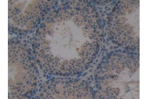 DAB staining on IHC-P; Samples: Mouse Testis Tissue (PKC mu Antikörper  (AA 349-612))