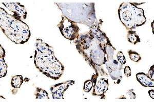 IHC analysis of MAFF using anti-MAFF antibody (ABIN7599317). (MafF Antikörper  (AA 1-37))