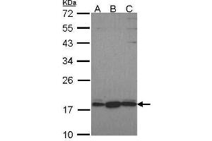 WB Image Sample (30 ug of whole cell lysate) A: Hela B: JurKat C: NT2D1 12% SDS PAGE GNRPX antibody antibody diluted at 1:1000 (GNRPX Antikörper  (C-Term))