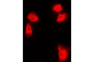 Immunofluorescent analysis of NF-kappaB p100 staining in HEK293T cells. (NFKB2 Antikörper  (C-Term))