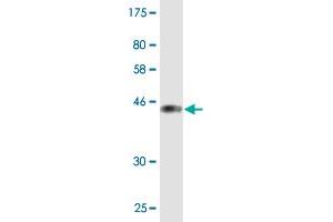 Western Blot detection against Immunogen (37. (PIP5K1C Antikörper  (AA 561-667))