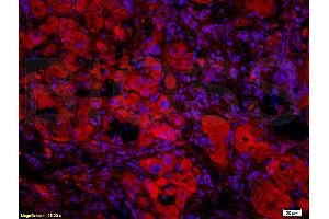 Formalin-fixed and paraffin-embedded: rat liver tissue labeled with Rabbit Anti-BAFF/CD257 Polyclonal Antibody, Unconjugated (ABIN740175) 1:200 followed by conjugation to the secondary Cy3 antibody (BAFF Antikörper  (AA 221-309))