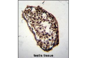 Immunohistochemistry (Paraffin-embedded Sections) (IHC (p)) image for anti-Myeloid Leukemia Factor 1 (MLF1) (AA 215-244), (C-Term) antibody (ABIN652233)