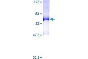 SNX16 Protein (AA 1-344) (GST tag)