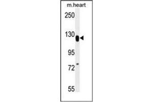 Western blot analysis of MED14 Antibody (Center) in mouse heart tissue lysates (35ug/lane).