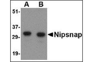 Western blot analysis of NIPSNAP in human brain tissue lysate with this product at (A) 0. (NIPSNAP1 Antikörper  (Center))