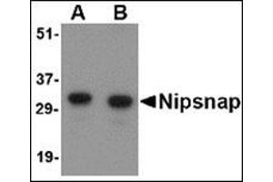 Western blot analysis of NIPSNAP in human brain tissue lysate with this product at (A) 0. (NIPSNAP1 Antikörper  (Center))