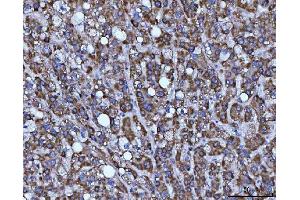 IHC analysis of BBS9 using anti-BBS9 antibody (ABIN7601518). (BBS9 Antikörper  (AA 37-793))
