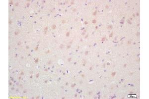 Formalin-fixed and paraffin embedded rat brain labeled with Rabbit Anti TAK1/MAP3K7 Polyclonal Antibody, Unconjugated  at 1:200 followed by conjugation to the secondary antibody and DAB staining (TR4 Antikörper  (AA 560-600))