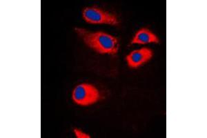 Immunofluorescent analysis of RPS9 staining in Jurkat cells. (RPS9 Antikörper  (Center))