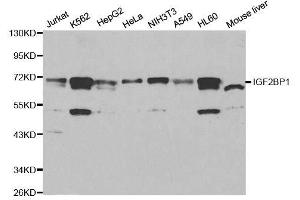 Western blot analysis of extracts of various cell lines, using IGF2BP1 antibody. (IGF2BP1 Antikörper  (C-Term))
