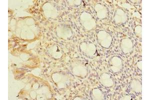 Immunohistochemistry of paraffin-embedded human colon tissue using ABIN7148768 at dilution of 1:100 (CWF19L1 Antikörper  (AA 101-330))