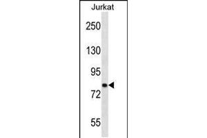 Western blot analysis in Jurkat cell line lysates (35ug/lane). (CACNB2 Antikörper  (AA 232-261))