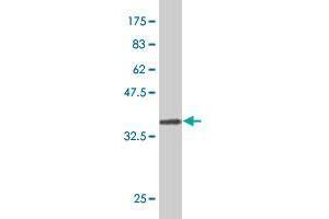 Western Blotting (WB) image for anti-Collagen, Type XXVI, alpha 1 (COL26A1) (AA 380-440) antibody (ABIN530734)