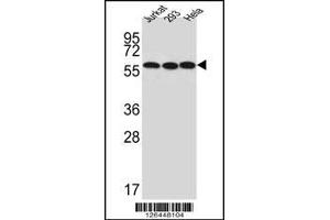 Western blot analysis of UTP6 Antibody in Jurkat,293,Hela cell line lysates (35ug/lane)