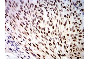 Immunohistochemistry (IHC) image for anti-DEAD (Asp-Glu-Ala-Asp) Box Polypeptide 1 (DDX1) (AA 642-740) antibody (ABIN5542504)