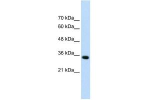 ADAMTS4 antibody used at 0. (ADAMTS4 Antikörper  (N-Term))