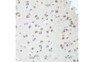 Immunohistochemistry of paraffin-embedded rat brain using SAP18 antibody at dilution of 1:100 (40x lens). (SAP18 Antikörper)