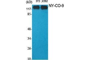 Western Blot (WB) analysis of specific cells using NY-CO-9 Polyclonal Antibody. (HDAC5 Antikörper  (C-Term))