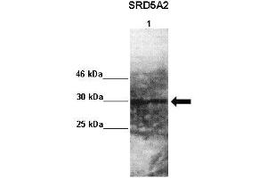 Lanes : Lane 1: 50ug monkey brain extract  Primary Antibody Dilution :  1:1000   Secondary Antibody : Goat anti rabbit-HRP  Secondary Antibody Dilution :  1:10,000  Gene Name : SRD5A2  Submitted by : Jonathan Bertin, Endoceutics Inc. (SRD5A2 Antikörper  (N-Term))