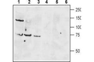Western blot analysis of rat brain lysate (lanes 1 and 4), mouse brain membranes (lanes 2 and 5) and human Jurkat T cell leukemia cell lysate (lanes 3 and 6): - 1-3. (VIPR1 Antikörper  (Extracellular, N-Term))