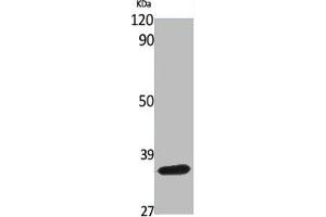 Western Blot analysis of various cells using BNIP-2 Polyclonal Antibody (BNIP2 Antikörper  (Internal Region))