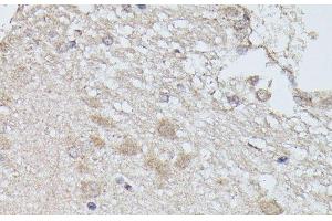Immunohistochemistry of paraffin-embedded Rat brain using PPP2R5D Polyclonal Antibody at dilution of 1:100 (40x lens). (PPP2R5D Antikörper)