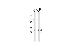 Western blot analysis of lysates from 293,Hela cell line (from left to right),using MRPL14 Antibody (ABIN6241786). (MRPL14 Antikörper)