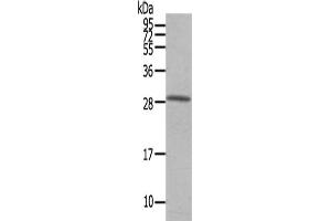 Gel: 12 % SDS-PAGE,Lysate: 40 μg,Primary antibody: ABIN7191746(OSM Antibody) at dilution 1/200 dilution,Secondary antibody: Goat anti rabbit IgG at 1/8000 dilution,Exposure time: 40 seconds (Oncostatin M Antikörper)