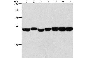 Western Blot analysis of Hela, A431 and hepG2 cell, Mouse brain and liver tissue, Mouse pancreas and Human fetal brain tissue using ENO1 Polyclonal Antibody at dilution of 1:700 (ENO1 Antikörper)