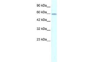 Human Jurkat; WB Suggested Anti-ZNF543 Antibody Titration: 0. (ZNF543 Antikörper  (Middle Region))