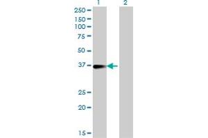 Western Blot analysis of FCER2 expression in transfected 293T cell line by FCER2 monoclonal antibody (M14), clone 2A7. (FCER2 Antikörper  (AA 1-321))