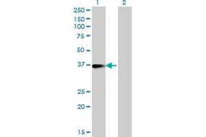 Western Blot analysis of FCER2 expression in transfected 293T cell line by FCER2 monoclonal antibody (M14), clone 2A7.